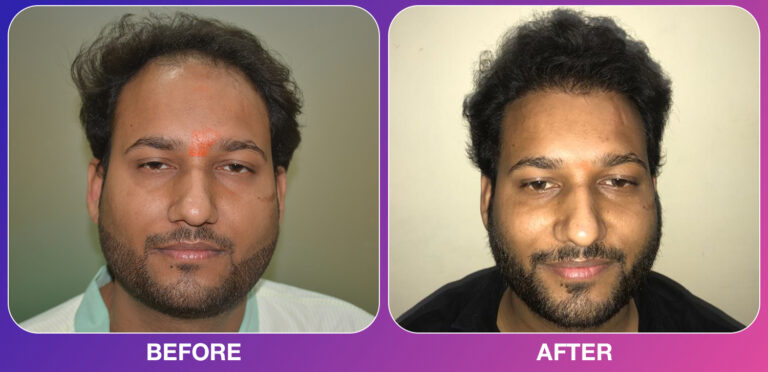 cosmo experts clinic before after