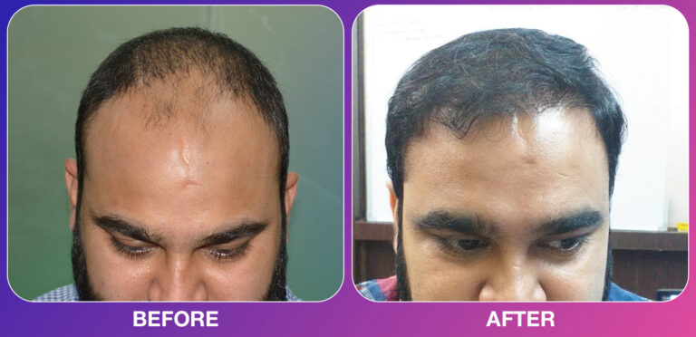 cosmo experts clinic before after