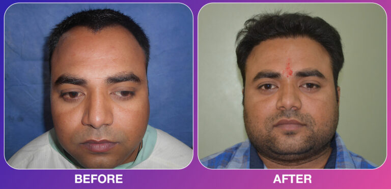 cosmo experts clinic result